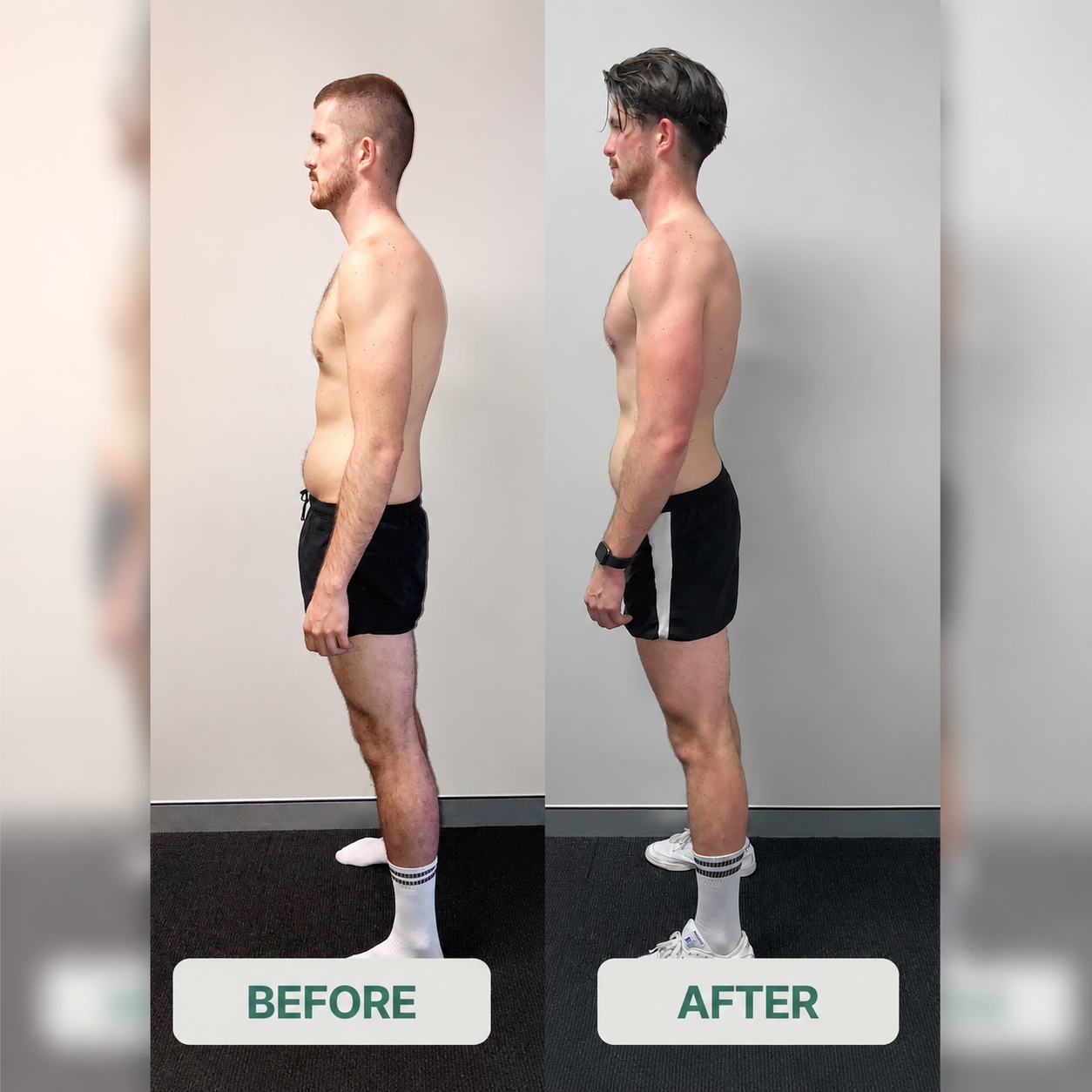 Rejuvex™ Posture Corrector + Free Massage Roller — Instant Back Support